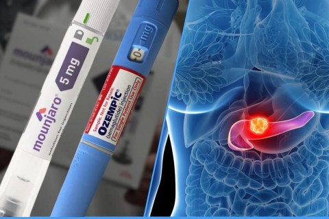 Canetas emagracedoras acendem alerta  no Reino Unido após casos de pancreatite aguda