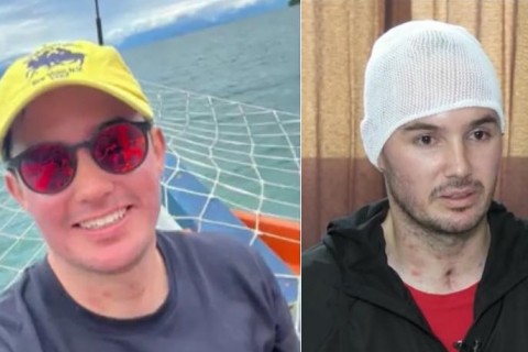 Homem que passou 45 dias internado por causa do metanol recebe alta e fala da preocupação com o futuro: 'Eu ajudo meu pai e minha mãe'.